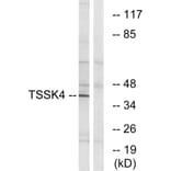 Western Blot - Anti-TSSK4 Antibody (C19097) - Antibodies.com