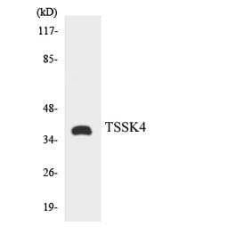 Western Blot - Anti-TSSK4 Antibody (R12-3655) - Antibodies.com