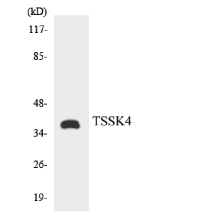 Western Blot - Anti-TSSK4 Antibody (R12-3655) - Antibodies.com