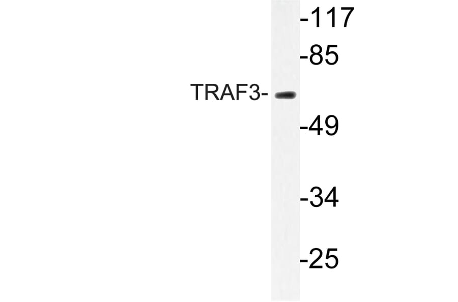Western Blot - Anti-TRAF3 Antibody (R12-2385) - Antibodies.com