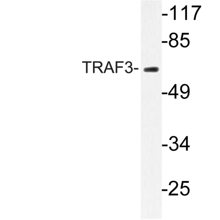 Western Blot - Anti-TRAF3 Antibody (R12-2385) - Antibodies.com