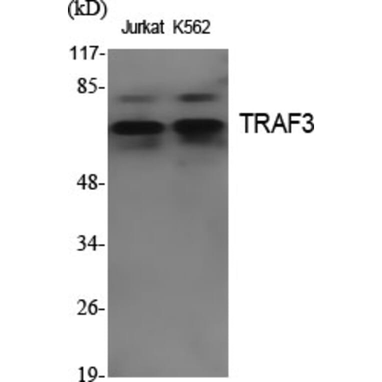 Western Blot - Anti-TRAF3 Antibody (R12-2385) - Antibodies.com