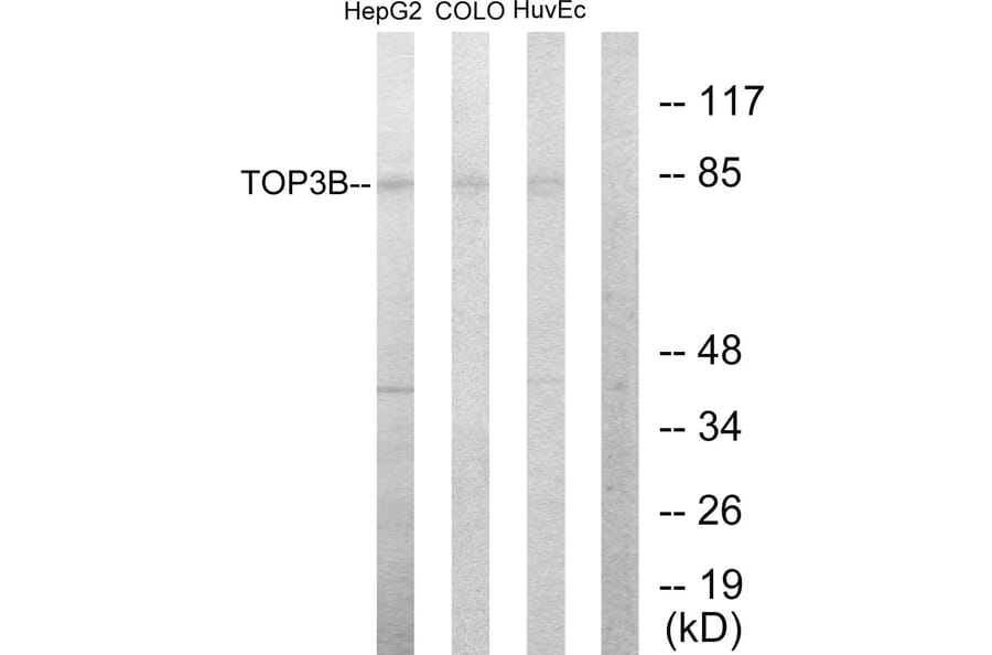 Western Blot - Anti-TOP3B Antibody (C10251) - Antibodies.com