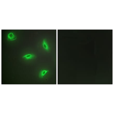 Immunofluorescence - Anti-TNF14 Antibody (C10109) - Antibodies.com