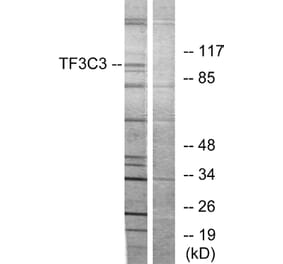 Western Blot - Anti-TF3C3 Antibody (C11971) - Antibodies.com
