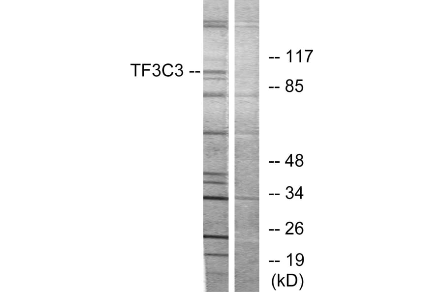 Western Blot - Anti-TF3C3 Antibody (C11971) - Antibodies.com