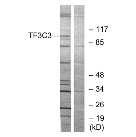 Western Blot - Anti-TF3C3 Antibody (C11971) - Antibodies.com