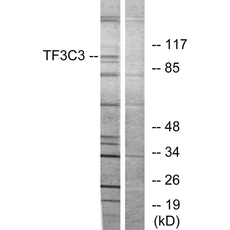 Western Blot - Anti-TF3C3 Antibody (C11971) - Antibodies.com