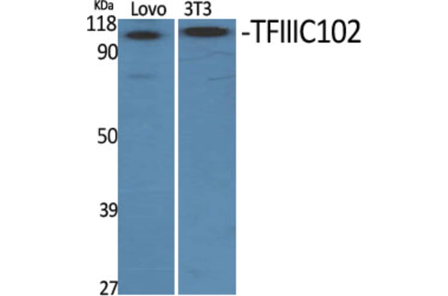 Western Blot - Anti-TF3C3 Antibody (C11971) - Antibodies.com