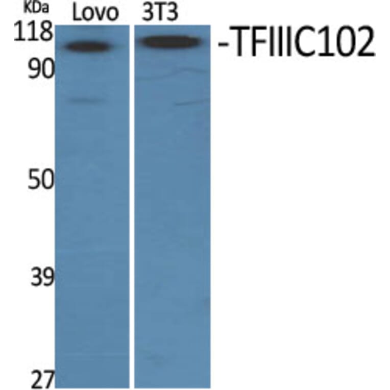 Western Blot - Anti-TF3C3 Antibody (C11971) - Antibodies.com
