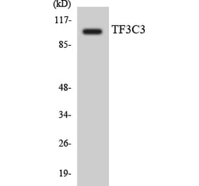 Western Blot - Anti-TF3C3 Antibody (R12-3615) - Antibodies.com