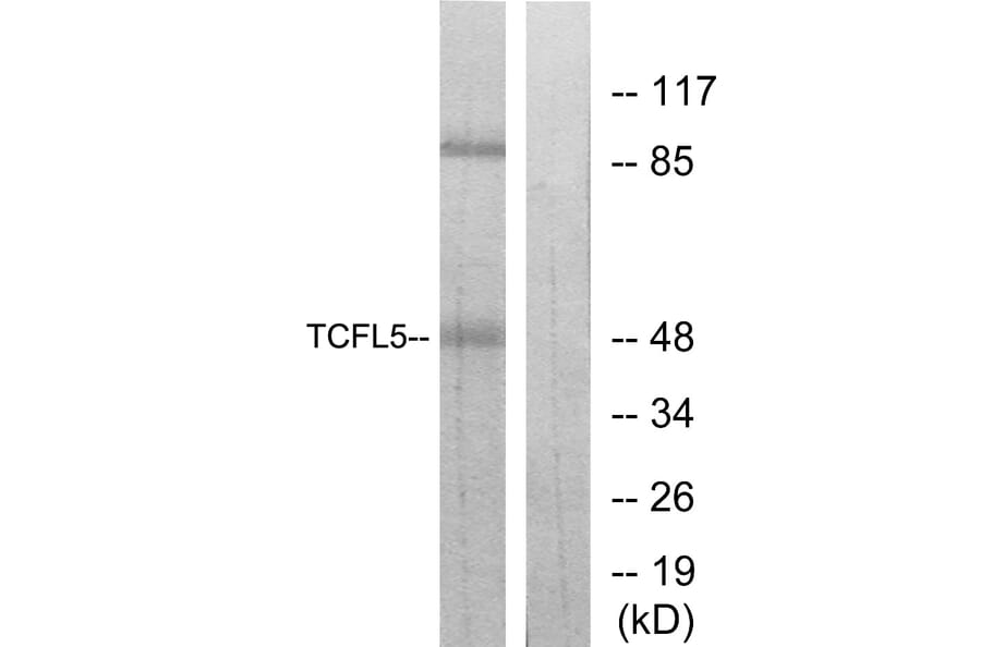 Western Blot - Anti-TCFL5 Antibody (C11878) - Antibodies.com