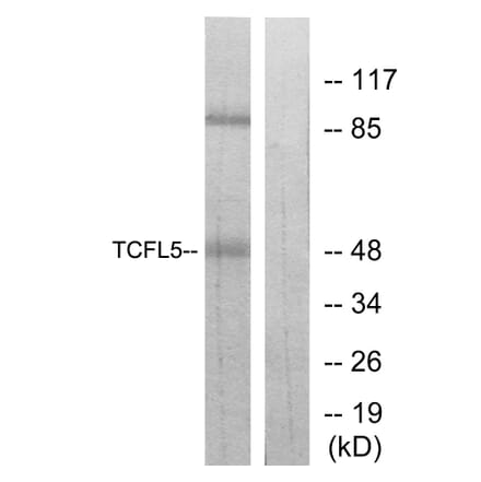 Western Blot - Anti-TCFL5 Antibody (C11878) - Antibodies.com