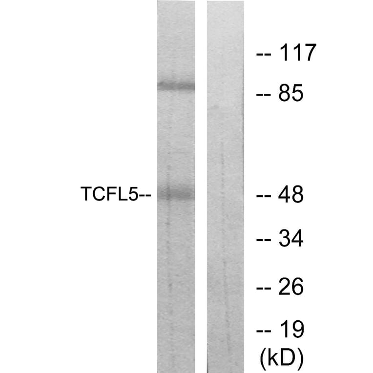 Western Blot - Anti-TCFL5 Antibody (C11878) - Antibodies.com