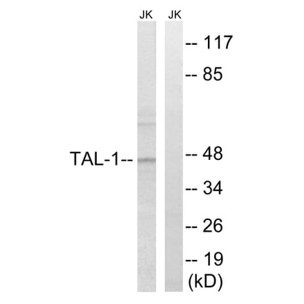 Western Blot - Anti-TAL-1 Antibody (B8431) - Antibodies.com