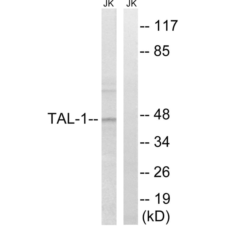 Western Blot - Anti-TAL-1 Antibody (B8431) - Antibodies.com