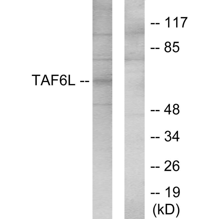 Western Blot - Anti-TAF6L Antibody (C11986) - Antibodies.com