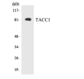 Western Blot - Anti-TACC1 Antibody (R12-3581) - Antibodies.com