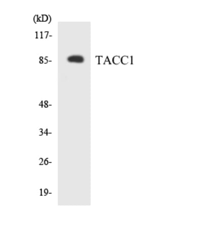 Western Blot - Anti-TACC1 Antibody (R12-3581) - Antibodies.com