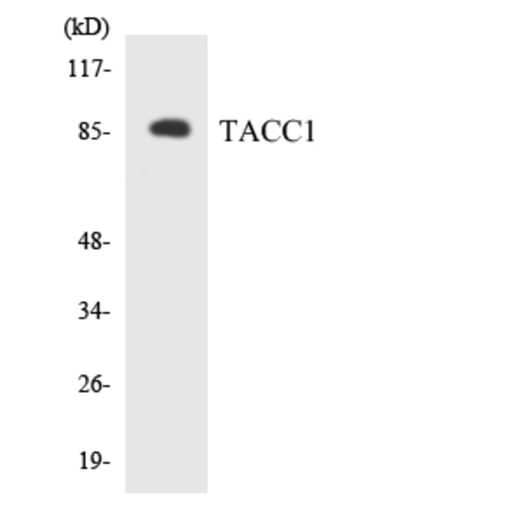 Western Blot - Anti-TACC1 Antibody (R12-3581) - Antibodies.com
