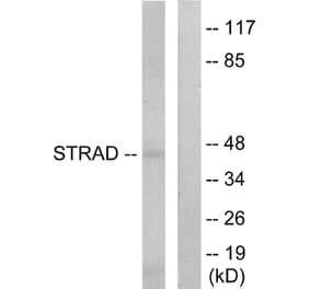 Western Blot - Anti-STRAD Antibody (C11258) - Antibodies.com