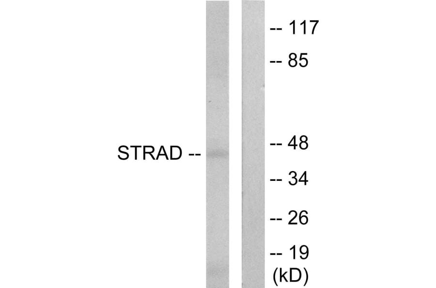 Western Blot - Anti-STRAD Antibody (C11258) - Antibodies.com