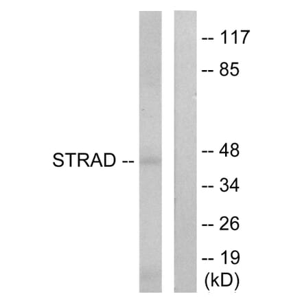 Western Blot - Anti-STRAD Antibody (C11258) - Antibodies.com