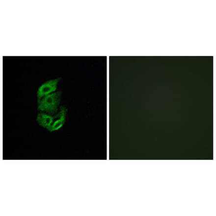 Immunofluorescence - Anti-STA13 Antibody (C11950) - Antibodies.com