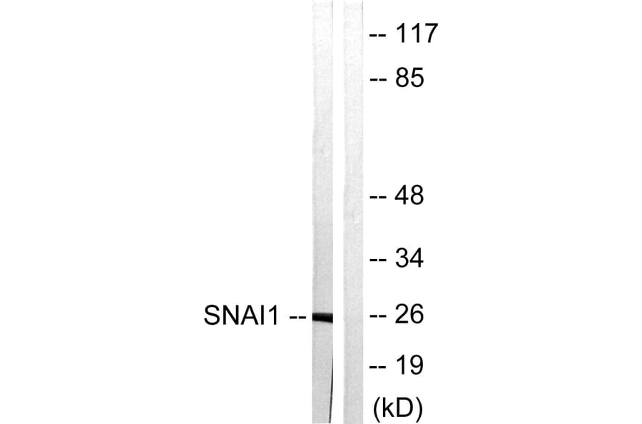 Western Blot - Anti-SNAI1 Antibody (B1235) - Antibodies.com