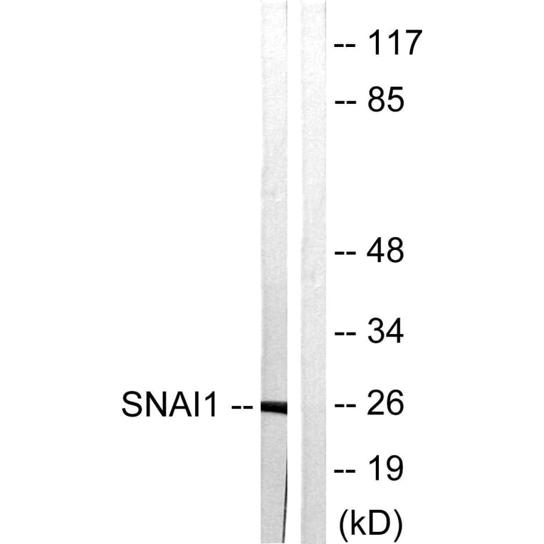 Western Blot - Anti-SNAI1 Antibody (B1235) - Antibodies.com