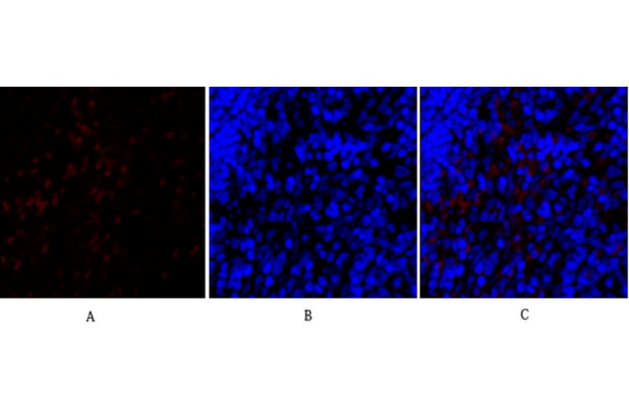 Immunofluorescence - Anti-SNAI1 Antibody (B1235) - Antibodies.com