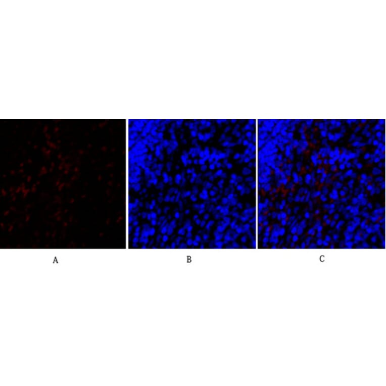 Immunofluorescence - Anti-SNAI1 Antibody (B1235) - Antibodies.com