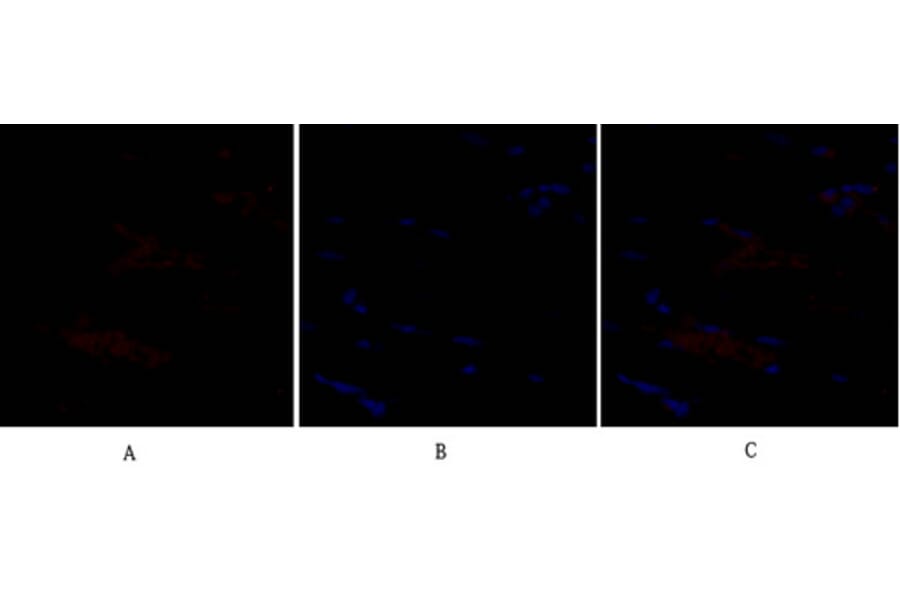 Immunofluorescence - Anti-SNAI1 Antibody (B1235) - Antibodies.com