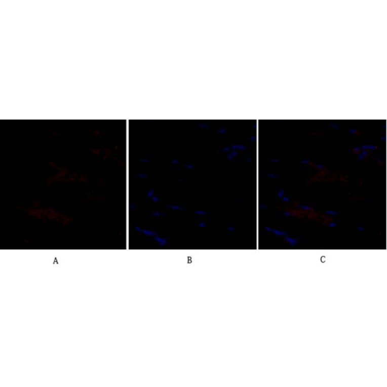 Immunofluorescence - Anti-SNAI1 Antibody (B1235) - Antibodies.com