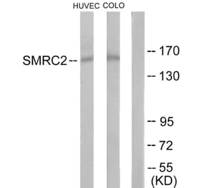 Western Blot - Anti-SMRC2 Antibody (C11383) - Antibodies.com