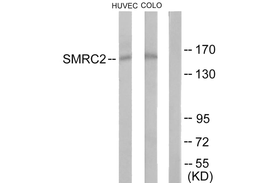 Western Blot - Anti-SMRC2 Antibody (C11383) - Antibodies.com