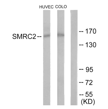 Western Blot - Anti-SMRC2 Antibody (C11383) - Antibodies.com