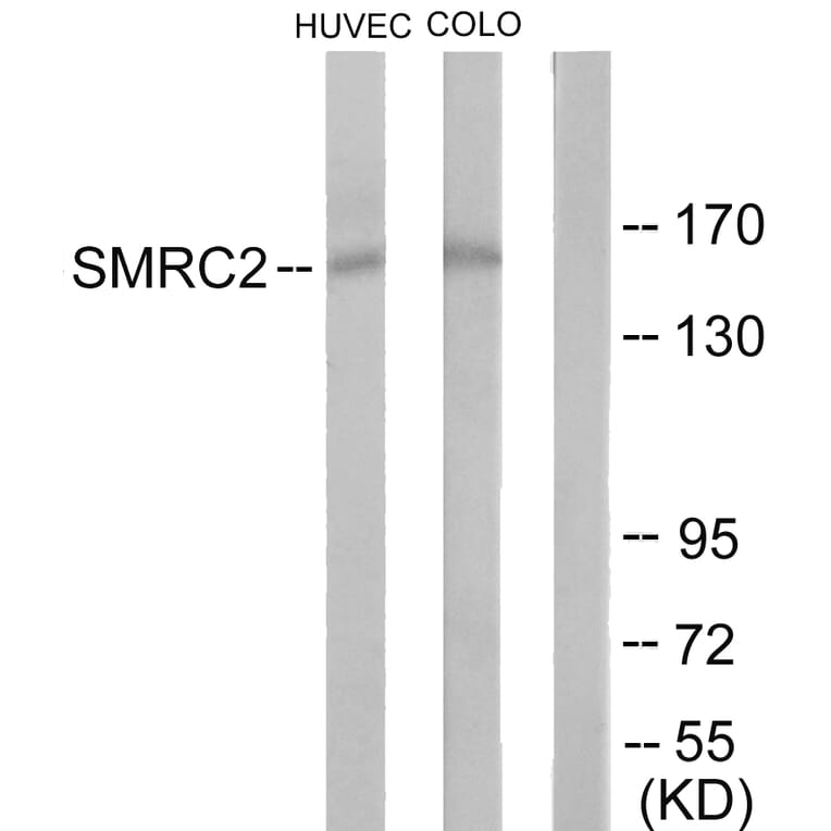 Western Blot - Anti-SMRC2 Antibody (C11383) - Antibodies.com