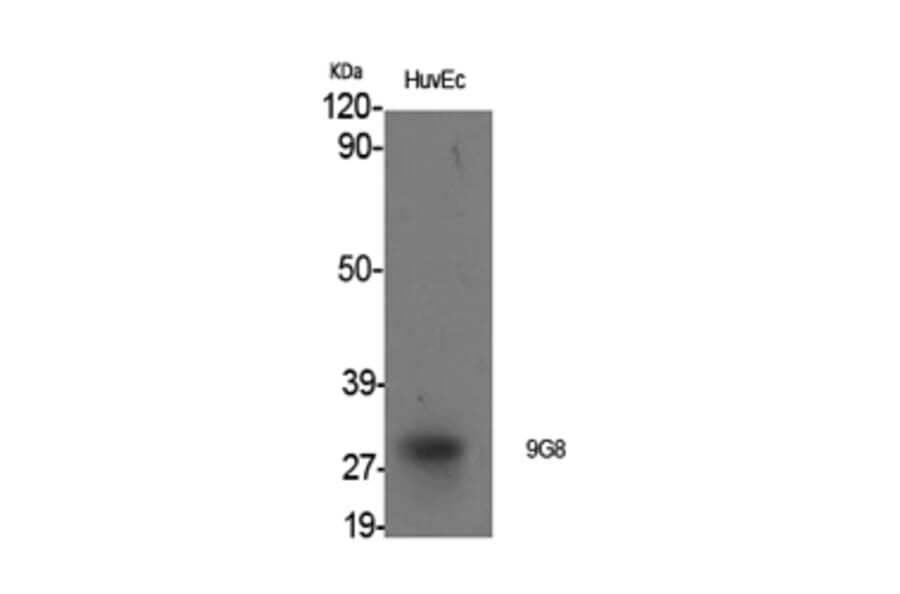 Western Blot - Anti-SFRS7 Antibody (C18943) - Antibodies.com