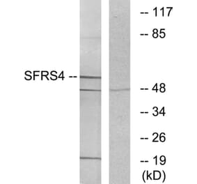 Western Blot - Anti-SFRS4 Antibody (C10906) - Antibodies.com