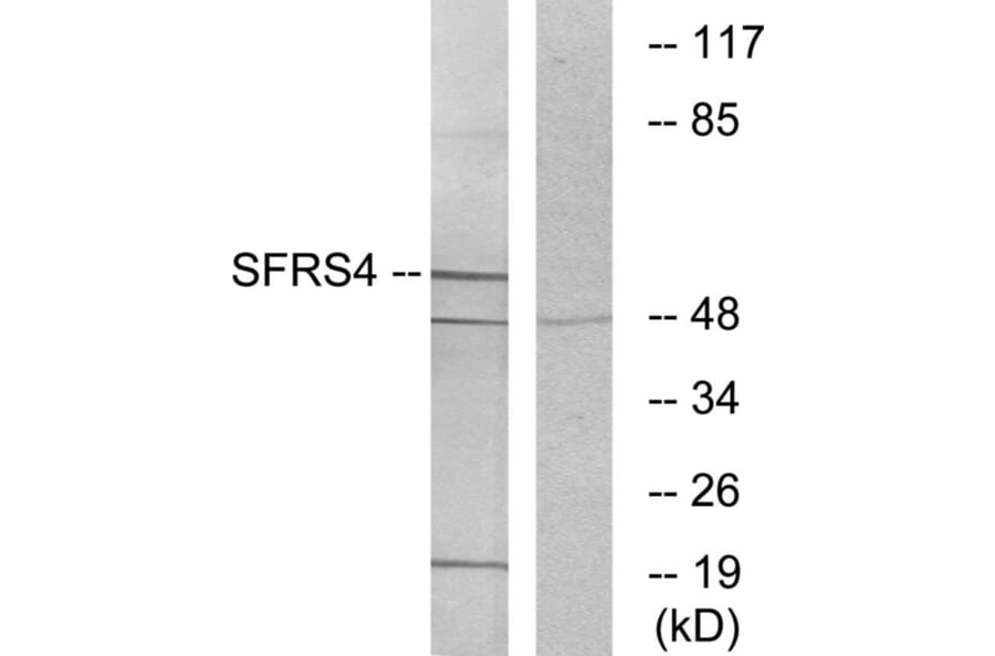 Western Blot - Anti-SFRS4 Antibody (C10906) - Antibodies.com