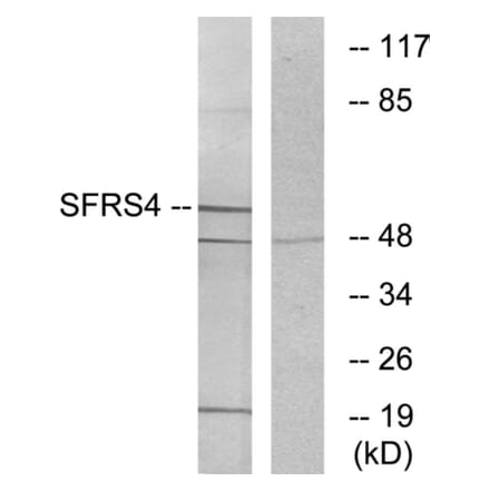 Western Blot - Anti-SFRS4 Antibody (C10906) - Antibodies.com