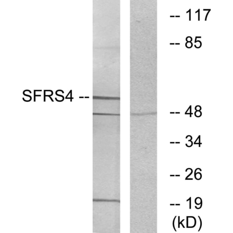 Western Blot - Anti-SFRS4 Antibody (C10906) - Antibodies.com