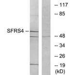Western Blot - Anti-SFRS4 Antibody (C10906) - Antibodies.com