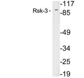 Western Blot - Anti-Rsk-3 Antibody (R12-2339) - Antibodies.com
