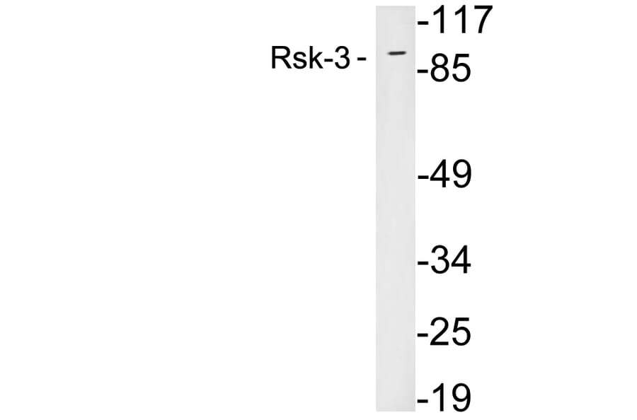 Western Blot - Anti-Rsk-3 Antibody (R12-2339) - Antibodies.com