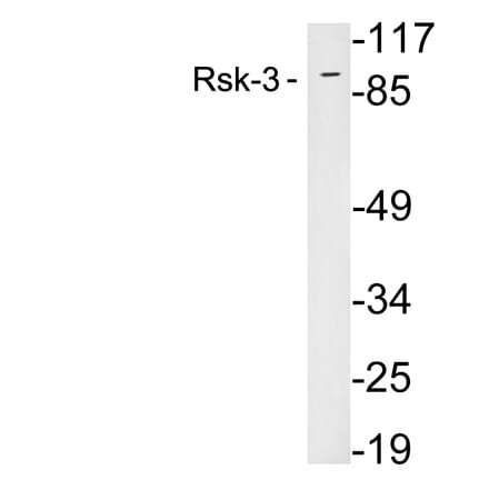 Western Blot - Anti-Rsk-3 Antibody (R12-2339) - Antibodies.com