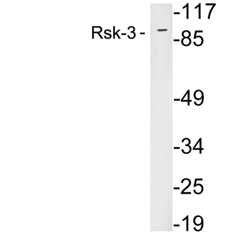 Western Blot - Anti-Rsk-3 Antibody (R12-2339) - Antibodies.com