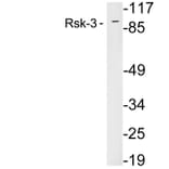 Western Blot - Anti-Rsk-3 Antibody (R12-2339) - Antibodies.com