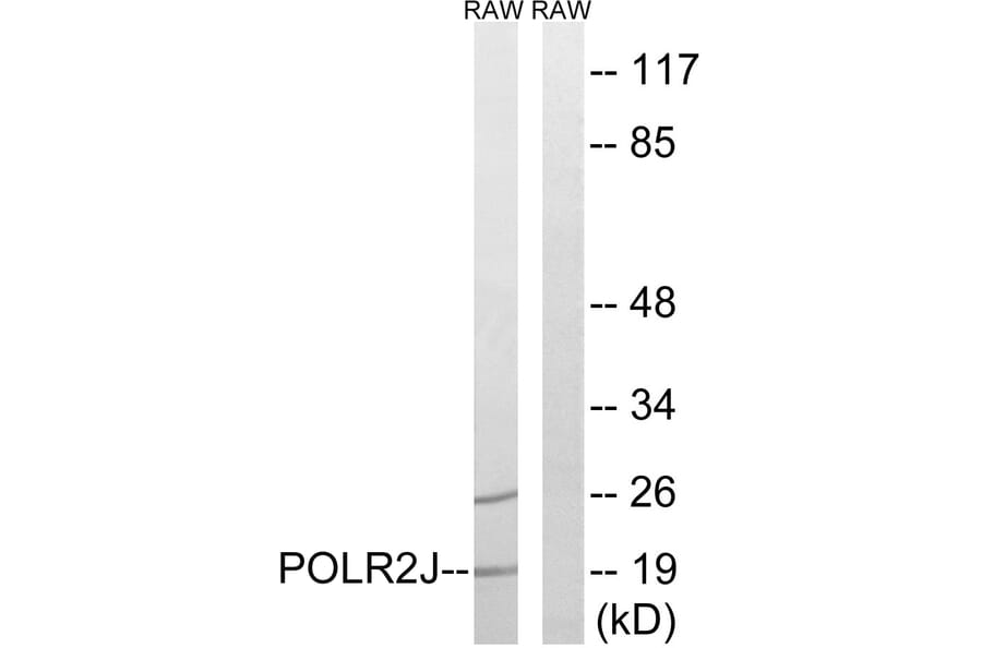Western Blot - Anti-RPB11 Antibody (C15467) - Antibodies.com